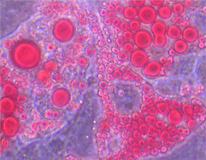 脂肪滴（赤く染色）を溜め込んだ脂肪細胞の画像