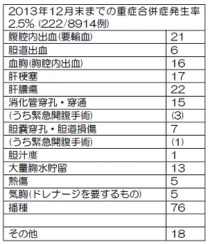 ラジオ波焼灼術の合併症
