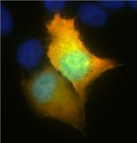 HeLa細胞 蛍光顕微鏡像