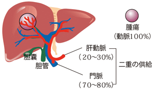 肝動脈塞栓術イメージ
