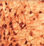 神経細胞 免疫染色像